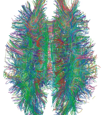 Các kết nối chất trắng trong não, thu được bằng MRI Tractography
Các kết nối chất trắng trong não, thu được bằng MRI Tractography. (Hình ảnh: Bởi Xavier Gigandet và cộng sự – Gigandet X, Hagmann P, Kurant M, Cammoun L, Meuli R, et al./Public domain)